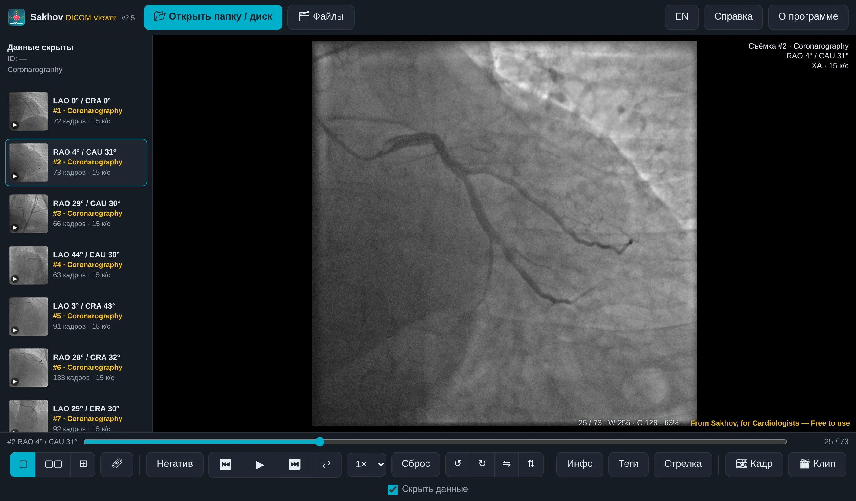 Sakhov DICOM Viewer